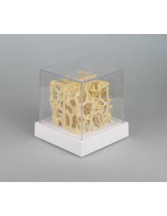 Erler Zimmer, confronto fra...