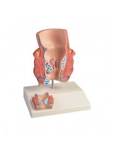 Erler Zimmer, Modello...