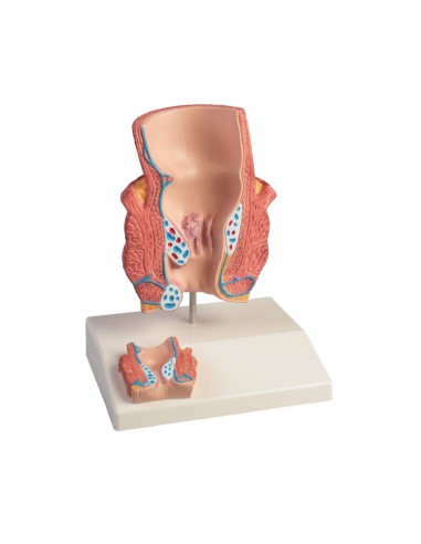 Erler Zimmer, Modello anatomico...