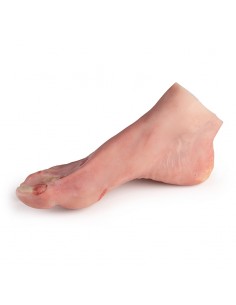 Piede ferito con sindrome... 2