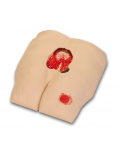 Simulatore di ulcera da...