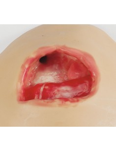 Simulatore per la terapia a... 2