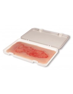 Moulage di ferita da ulcera...