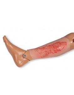 Moulage di ferita da ulcera... 2