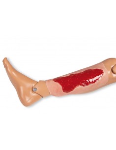 Moulage di ferita da ulcera... 2