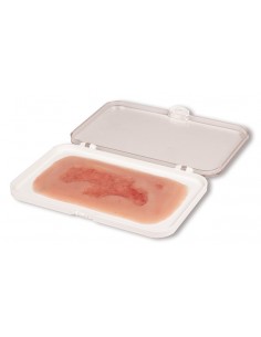 Moulage di ferita da ulcera...