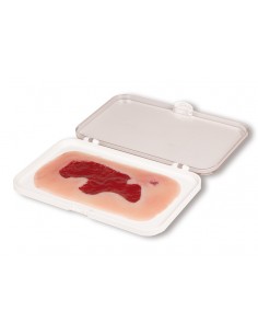 Moulage di ferita da ulcera...