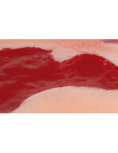 Moulage di ferita da ulcera... 2