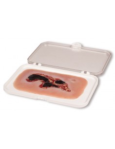 Moulage di ferita da ulcera...