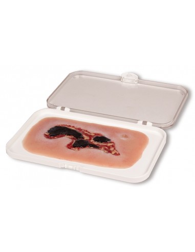 Moulage di ferita da ulcera arteriosa... Moulage di ferita da ulcera arteriosa...