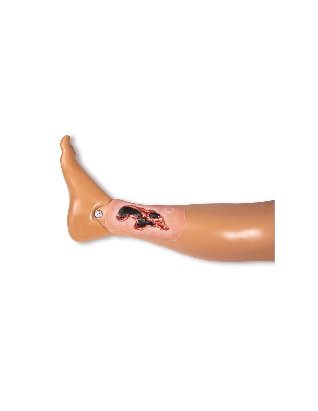 Moulage di ferita da ulcera arteriosa... Moulage di ferita da ulcera arteriosa...