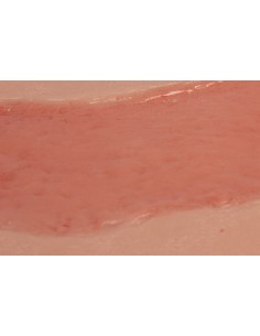 Moulage di ferita da ulcera... 2