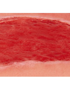 Moulage di ferita da ulcera... 2