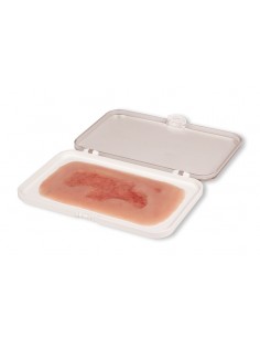 Moulage di ferita da ulcera...