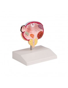 Malattie della vescica e...