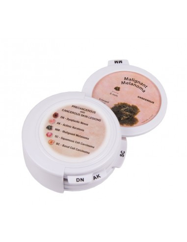 Lesioni cutanee, precancerose e...