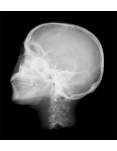 Simulatore per radiologia -... 2