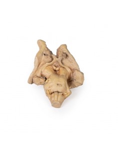 Tronco encefalico,... 2