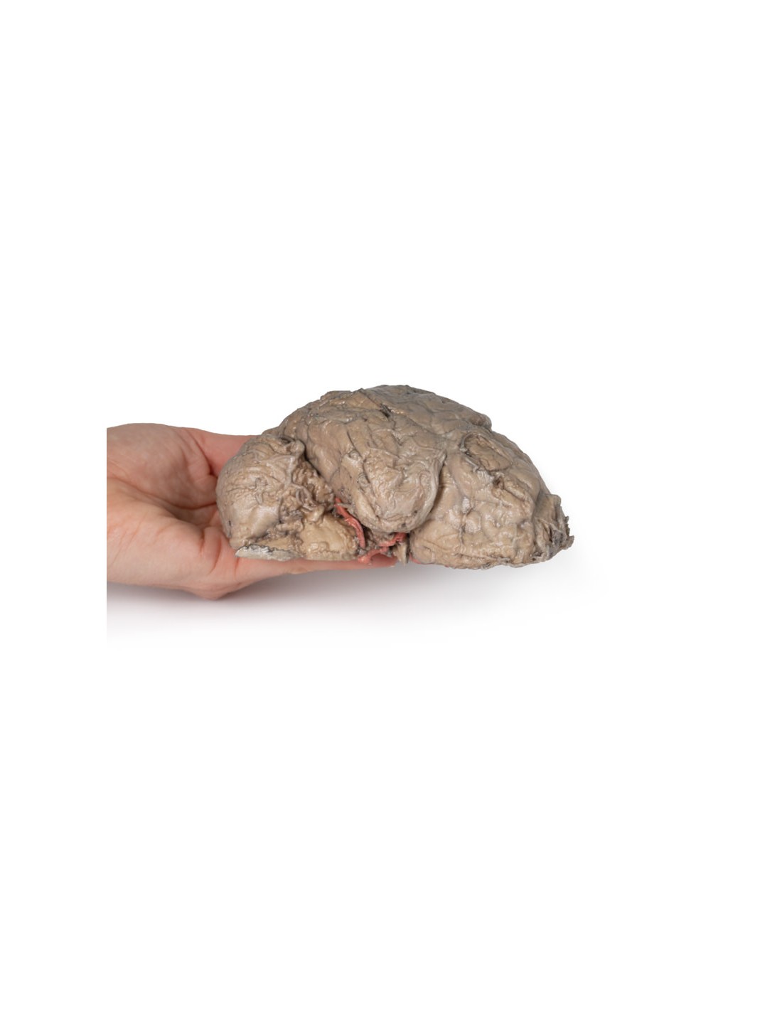 Emisezione cerebrale - Erler Zimmer... Emisezione cerebrale - Erler Zimmer...