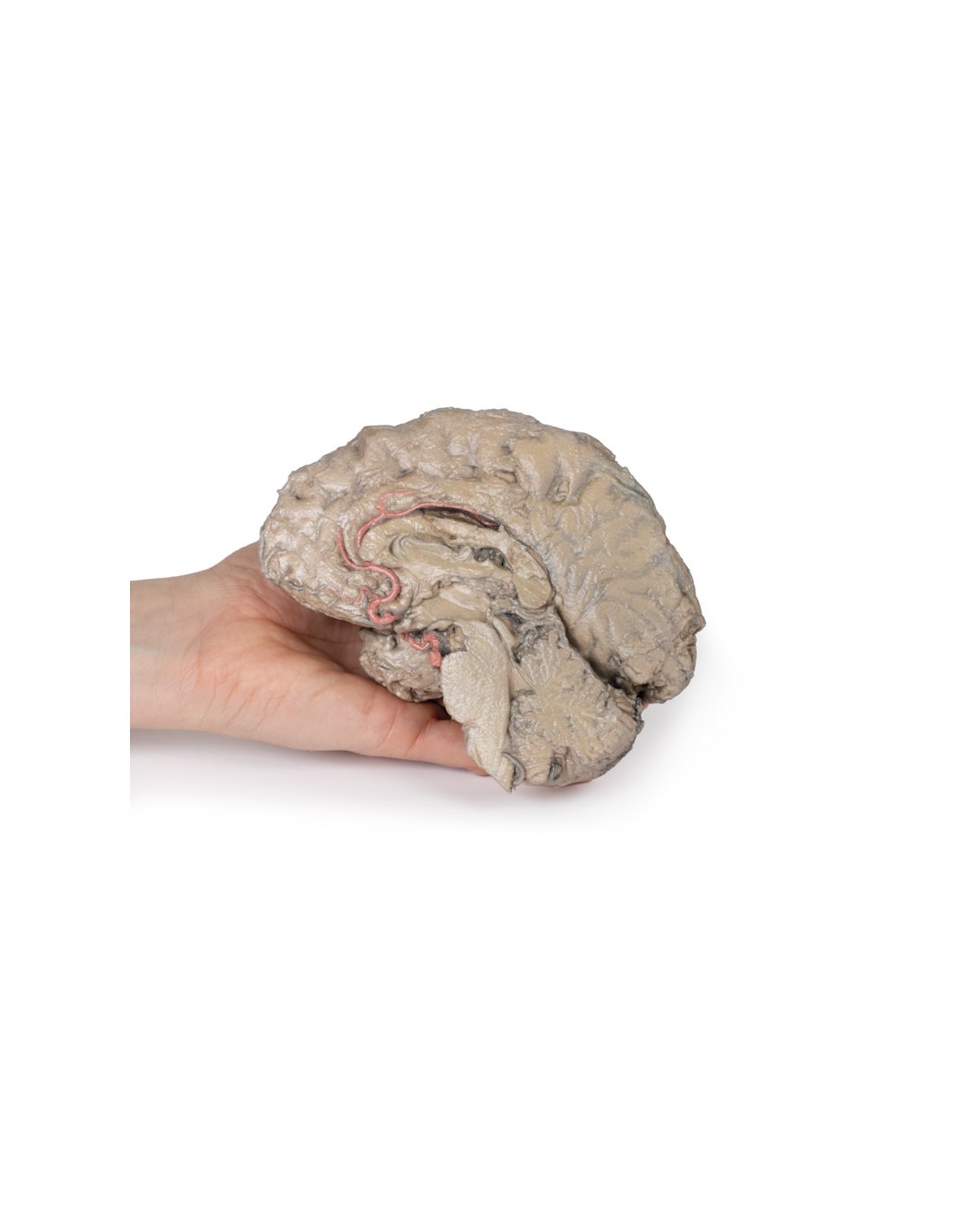 Emisezione cerebrale - Erler Zimmer... Emisezione cerebrale - Erler Zimmer...