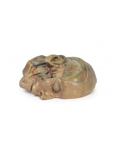 Sezione sagittale della... 2