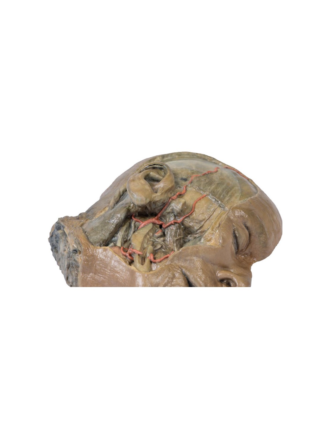 Sezione sagittale della testa con... Sezione sagittale della testa con...