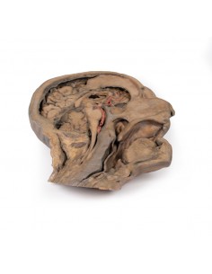 Sezione parasagittale della...