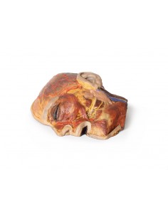 Nervi facciali superficiali... 2