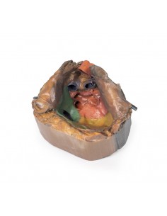 Spazio pericardico - Erler... 2