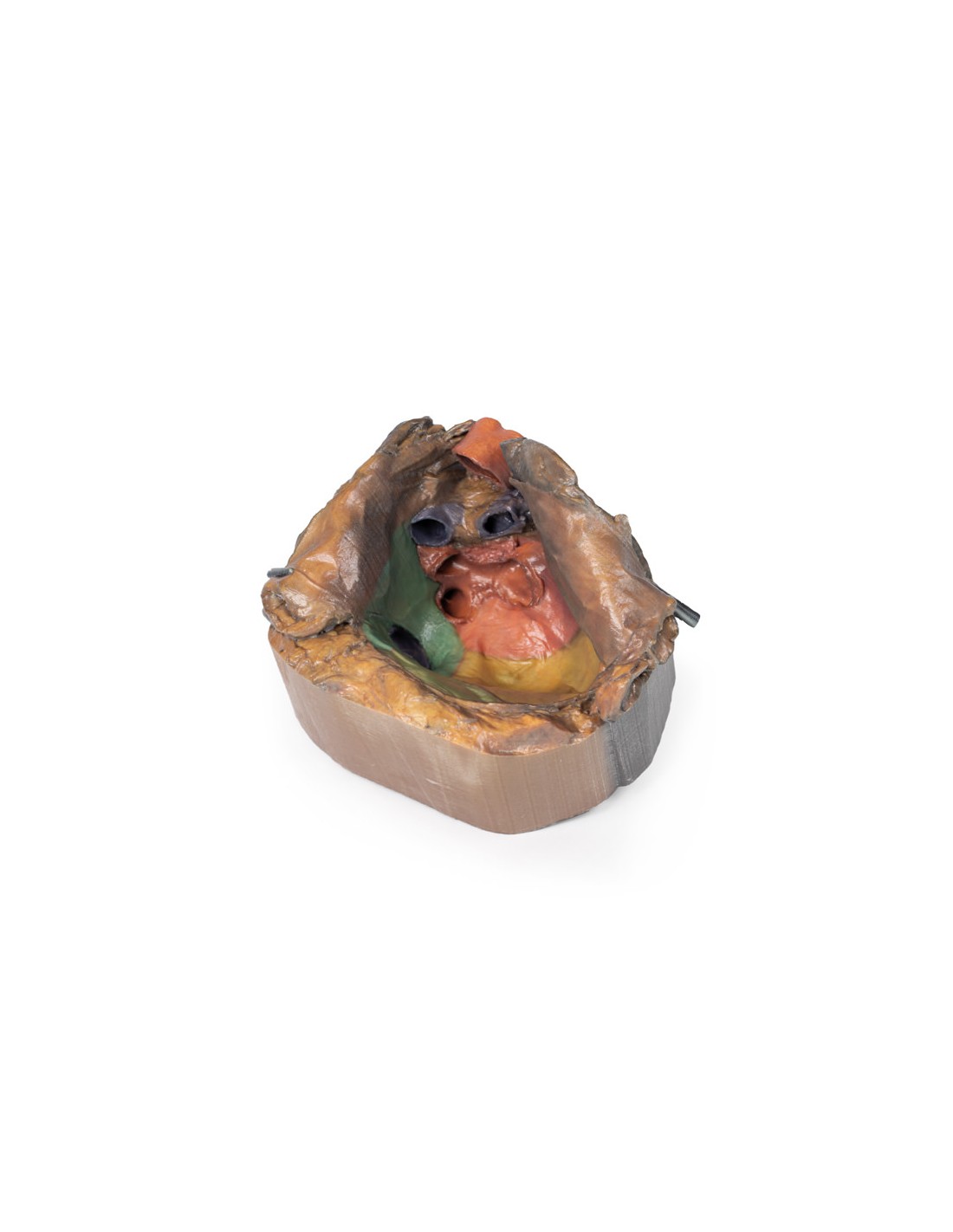 Spazio pericardico - Erler Zimmer 3D... Spazio pericardico - Erler Zimmer 3D...