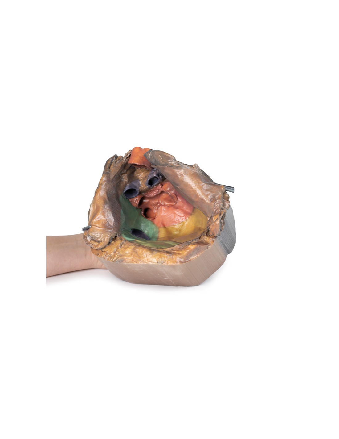 Spazio pericardico - Erler Zimmer 3D... Spazio pericardico - Erler Zimmer 3D...