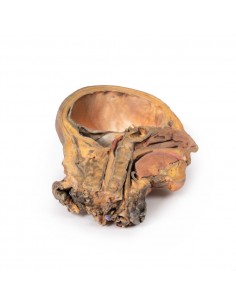 Sezione sagittale di testa... 2