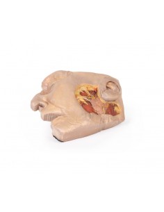 Dissezione della ghiandola...