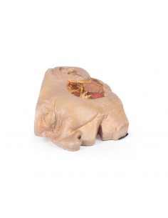 Dissezione della ghiandola... 2