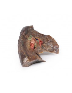 Ilo del polmone sinistro -...