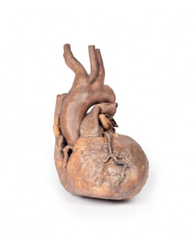 Dissezione del cuore umano - Erler...