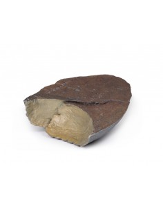 Polmone destro, ilo rimosso... 2