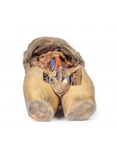 Dissezione dell'addome con... 2