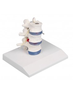 Erler Zimmer modello...