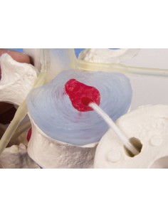 Erler Zimmer modello... 2