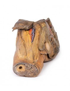 Dissezione di emipelvi e...