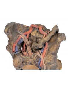 Dissezione profonda del... 2