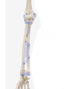 Erler Zimmer, modello... 2