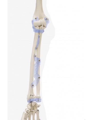 Erler Zimmer, modello anatomico di...