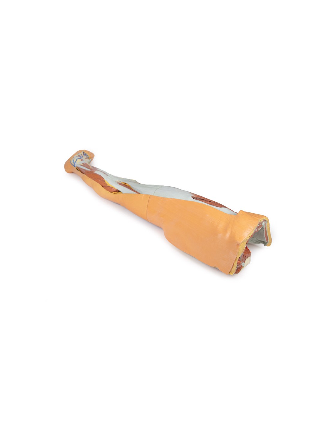 Dissezione superficiale dell'arto... Dissezione superficiale dell'arto...