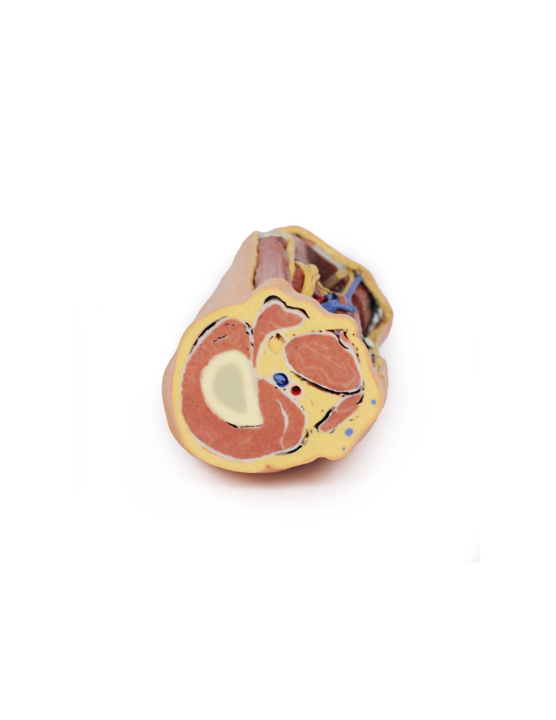 Fossa Poplitea con distale della... Fossa Poplitea con distale della...