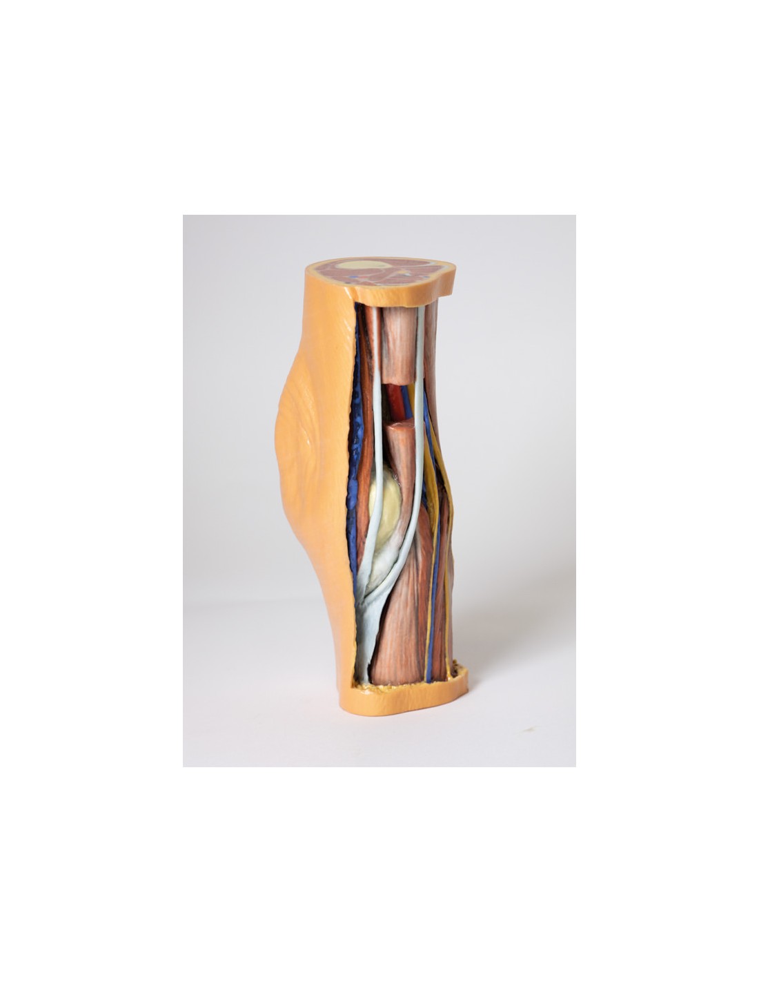 Dissezione profonda della Fossa... Dissezione profonda della Fossa...