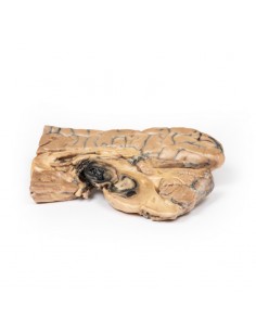 Aneurisma di Berry... 2