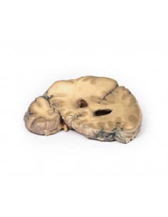 Adenocarcinoma metastatico... 2