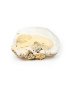 Adenoma ipofisario - Erler...